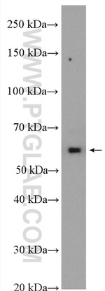 ANGPTL2 Antibody in Western Blot (WB)