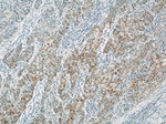 ACAA1 Antibody in Immunohistochemistry (Paraffin) (IHC (P))