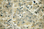 ACAA1 Antibody in Immunohistochemistry (Paraffin) (IHC (P))