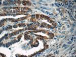 ACAA1 Antibody in Immunohistochemistry (Paraffin) (IHC (P))