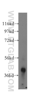 ACAA1 Antibody in Western Blot (WB)