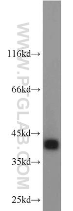 ACAA1 Antibody in Western Blot (WB)