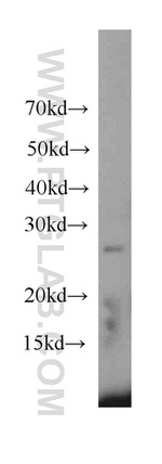 RAB3D Antibody in Western Blot (WB)