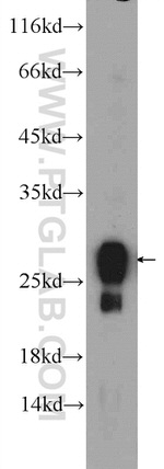 RAB3D Antibody in Western Blot (WB)