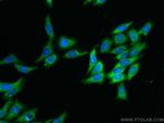 RAB3IP/Rabin8 Antibody in Immunocytochemistry (ICC/IF)