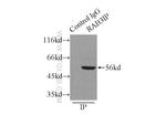 RAB3IP/Rabin8 Antibody in Immunoprecipitation (IP)