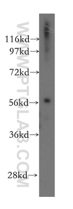 RAB3IP/Rabin8 Antibody in Western Blot (WB)
