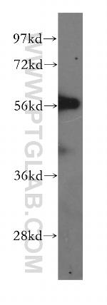 RAB3IP/Rabin8 Antibody in Western Blot (WB)
