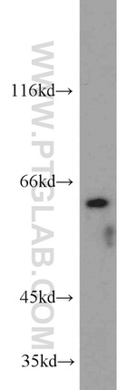 TRIP4 Antibody in Western Blot (WB)