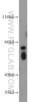 TRIP4 Antibody in Western Blot (WB)
