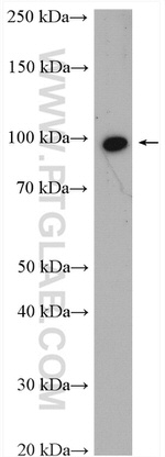 SCYL2 Antibody in Western Blot (WB)