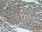 TIMP-4 Antibody in Immunohistochemistry (Paraffin) (IHC (P))