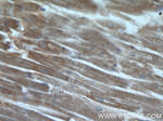 TIMP-4 Antibody in Immunohistochemistry (Paraffin) (IHC (P))