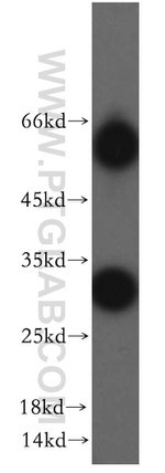 TIMP-4 Antibody in Western Blot (WB)