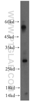 TIMP-4 Antibody in Western Blot (WB)