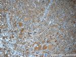 TIMP-4 Antibody in Immunohistochemistry (Paraffin) (IHC (P))
