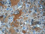 TIMP-4 Antibody in Immunohistochemistry (Paraffin) (IHC (P))