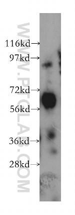 ARSG Antibody in Western Blot (WB)
