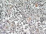 IDH1 Antibody in Immunohistochemistry (Paraffin) (IHC (P))
