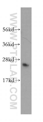 DNAJC12 Antibody in Western Blot (WB)