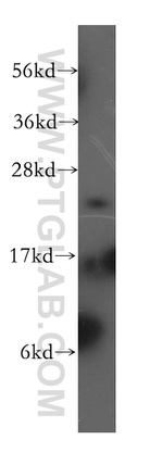 DNAJC12 Antibody in Western Blot (WB)