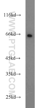SDPR Antibody in Western Blot (WB)