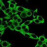 CD195 (CC-Chemokine Receptor 5) Monoclonal Antibody (12D1)