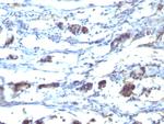 CD195 (CC-Chemokine Receptor 5) Antibody in Immunohistochemistry (Paraffin) (IHC (P))