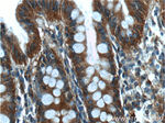RALB Antibody in Immunohistochemistry (Paraffin) (IHC (P))
