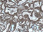 RALB Antibody in Immunohistochemistry (Paraffin) (IHC (P))