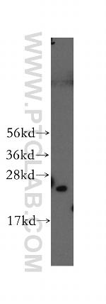 PSMD10 Antibody in Western Blot (WB)