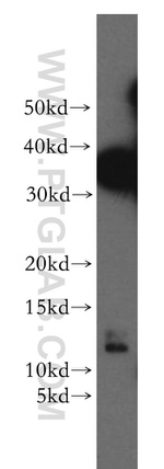 S100A3 Antibody in Western Blot (WB)