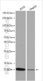 FABP5 Antibody in Western Blot (WB)