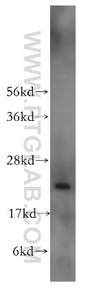 TAF12 Antibody in Western Blot (WB)
