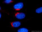 VTI1A Antibody in Immunocytochemistry (ICC/IF)