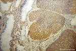 AKAP10 Antibody in Immunohistochemistry (Paraffin) (IHC (P))