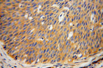 AKAP10 Antibody in Immunohistochemistry (Paraffin) (IHC (P))