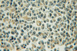 AKAP10 Antibody in Immunohistochemistry (Paraffin) (IHC (P))