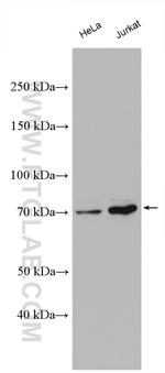 AKAP10 Antibody in Western Blot (WB)