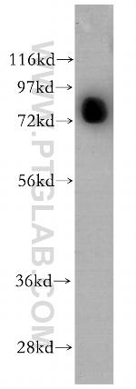 AKAP10 Antibody in Western Blot (WB)