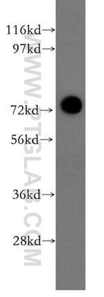 AKAP10 Antibody in Western Blot (WB)