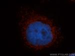 MRRF Antibody in Immunocytochemistry (ICC/IF)