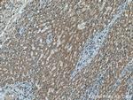 NDUFB3 Antibody in Immunohistochemistry (Paraffin) (IHC (P))