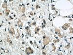 SYTL2 Antibody in Immunohistochemistry (Paraffin) (IHC (P))