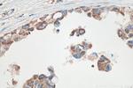 SYTL2 Antibody in Immunohistochemistry (Paraffin) (IHC (P))