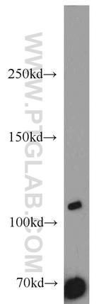 SYTL2 Antibody in Western Blot (WB)