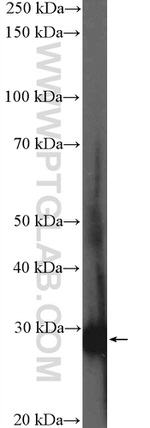 MXI1 Antibody in Western Blot (WB)