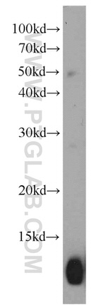 Hemoglobin epsilon Antibody in Western Blot (WB)