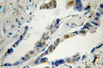 CCNDBP1 Antibody in Immunohistochemistry (Paraffin) (IHC (P))