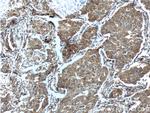 CCNDBP1 Antibody in Immunohistochemistry (Paraffin) (IHC (P))